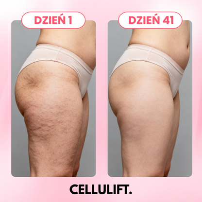 CelluLift - Masażer Antycelulitowy